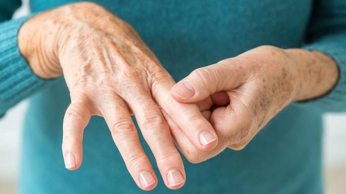 This Vitamin Supplement Can Help Prevent Rheumatoid Arthritis