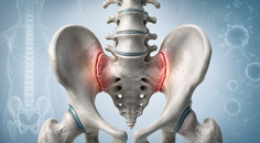 vunakizumab in radiographic axial spondyloarthritis trial