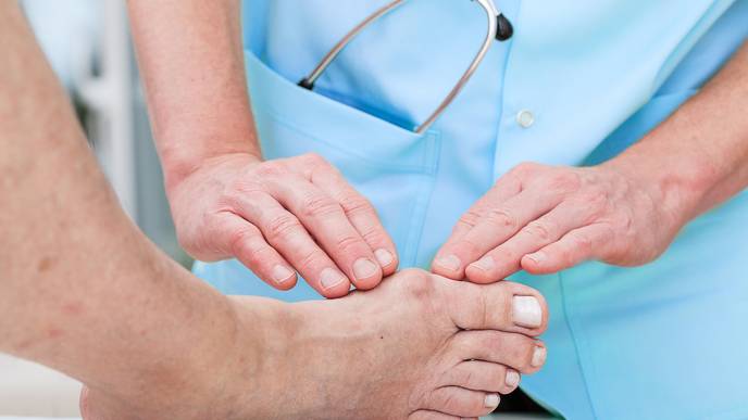 Can Fad Diets like Keto Lead to Gout?