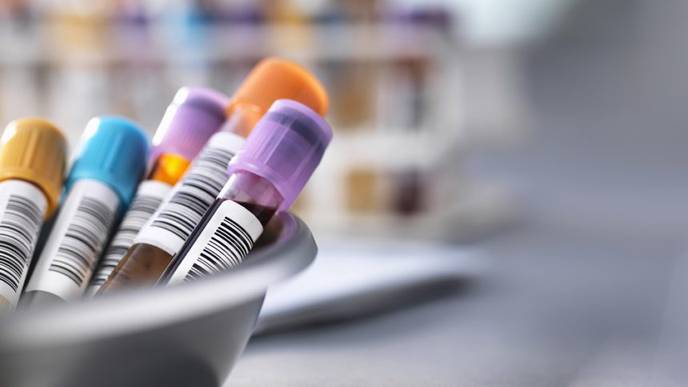 Hydroxychloroquine Blood Level Testing May Predict Retinopathy in SLE