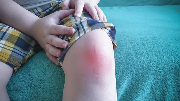 Genetic Data Can Improve Clinical Understanding of Juvenile Idiopathic Arthritis