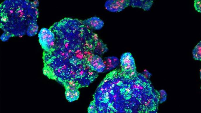 Epidemic of Autoimmune Diseases Calls for Action