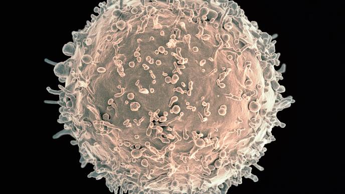 Finding Out Why the Immune System Attacks Itself