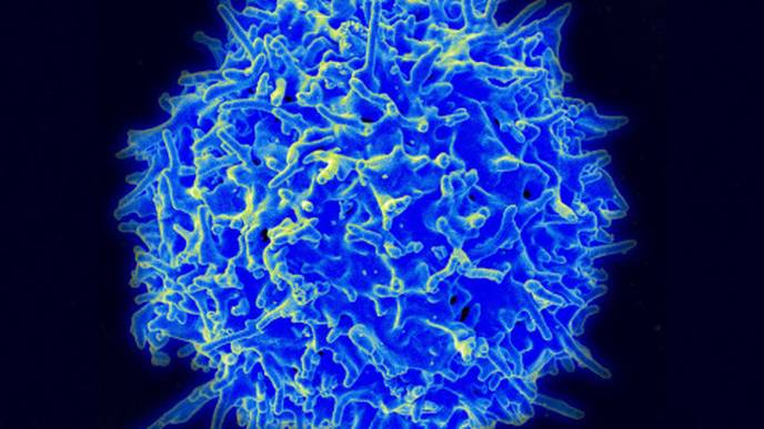 Scientists Identify Reversible Molecular Defect Underlying Rheumatoid Arthritis