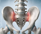 vunakizumab in radiographic axial spondyloarthritis trial