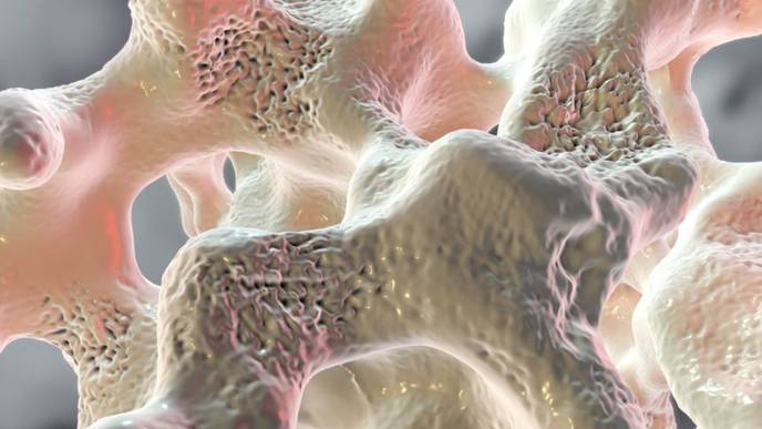 Romosozumab Increases Bone Formation, Reduces Bone Resorption