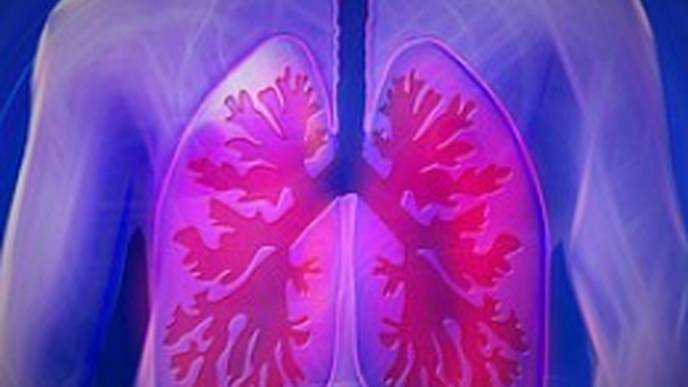 Lung Disease Increasingly Detected in Children with SJIA