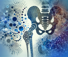 autologous cartilage cell approaches hip repair